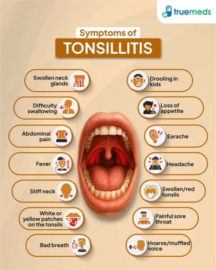 Can tonsillitis last for months?