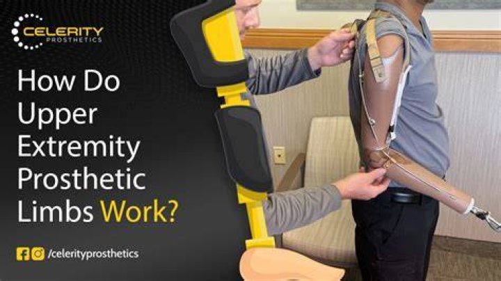 Do reattached limbs work?