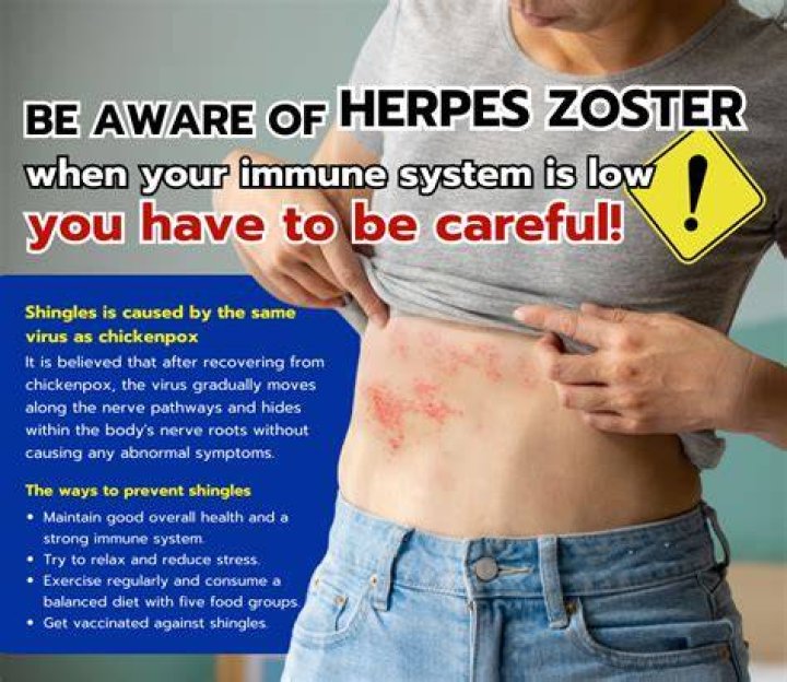 Does herpes weaken your immune system?