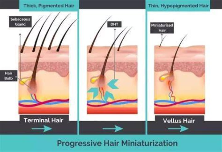 How to know if your hair is miniaturizing?