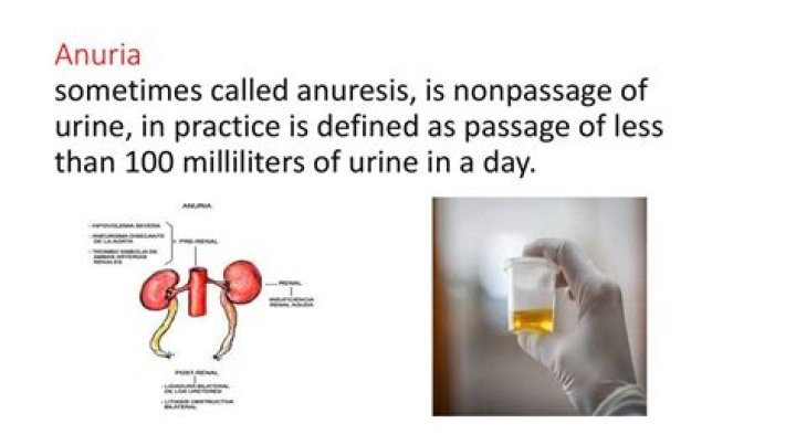 In medical terms what is a anuria?