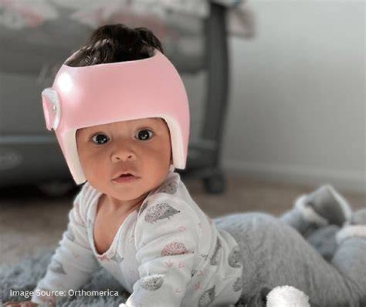 When to helmet baby?
